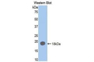 Detection of Recombinant F2, Rat using Monoclonal Antibody to Coagulation Factor II (F2) (Prothrombin antibody  (AA 201-323))