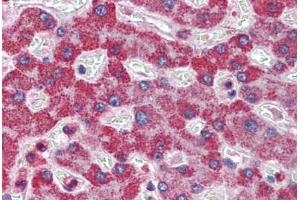 Human Liver: Formalin-Fixed, Paraffin-Embedded (FFPE) (ALDH5A1 antibody  (C-Term))