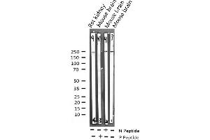 Western blot analysis of Phospho-WNK1 (Thr58) expression in various lysates (WNK1 antibody  (pThr60))