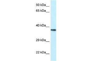 WB Suggested Anti-PSTPIP2 Antibody Titration: 1. (PSTPIP2 antibody  (Middle Region))