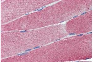 Human Skeletal Muscle: Formalin-Fixed, Paraffin-Embedded (FFPE) (Cell Adhesion Molecule 4 antibody  (AA 73-83))