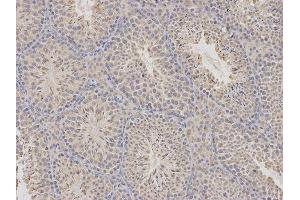 Immunohistochemistry (IHC) image for anti-Cytidine Deaminase (CDA) antibody (ABIN1871668) (CDA antibody)