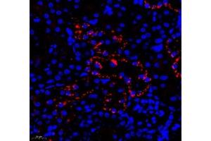 Immunofluorescent analysis of paraformaldehyde-fixed rat kidney using DPYS (ABIN7073732) at dilution of 1: 1200 (DPYS antibody)