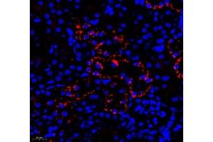 Immunofluorescent analysis of paraformaldehyde-fixed rat kidney using DPYS (ABIN7073732) at dilution of 1: 1200 (DPYS antibody)