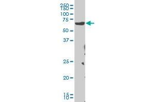 CHEK2 monoclonal antibody (M04), clone 4F10 Western Blot analysis of CHEK2 expression in Hela S3 NE . (CHEK2 antibody  (AA 1-543))