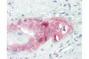 Human Placenta: Formalin-Fixed, Paraffin-Embedded (FFPE)
