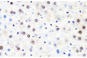 Immunohistochemistry of paraffin-embedded Rat liver using POLR2B Polyclonal Antibody at dilution of 1:100 (40x lens). (POLR2B antibody)