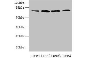 Western blot All lanes: DARS2 antibody at 16 μg/mL Lane 1: Mouse heart tissue Lane 2: Mouse liver tissue Lane 3: Mouse brain tissue Lane 4: Mouse skeletal muscle tissue Secondary Goat polyclonal to rabbit IgG at 1/10000 dilution Predicted band size: 73 kDa Observed band size: 73 kDa (FLRT3 antibody  (AA 209-264))