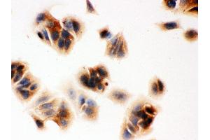 Anti- MASPIN Picoband antibody, ICC ICC: MCF-7 Cell (SERPINB5 antibody  (AA 1-350))