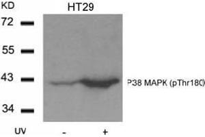 Image no. 1 for anti-Mitogen-Activated Protein Kinase 14 (MAPK14) (pThr180) antibody (ABIN197010) (MAPK14 antibody  (pThr180))