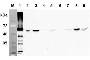 Western blot analysis of human FTO using anti-human FTO mAb (AG103)  at 1:1,000 dilution: 1. (FTO antibody)