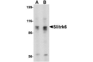 Image no. 1 for anti-SLIT and NTRK-Like Family, Member 6 (SLITRK6) (C-Term) antibody (ABIN1492200) (SLITRK6 antibody  (C-Term))
