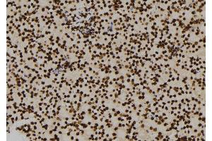 ABIN6276460 at 1/100 staining Mouse kidney tissue by IHC-P. (ENO1 antibody  (C-Term))