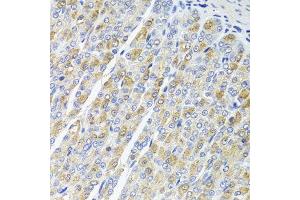 Immunohistochemistry of paraffin-embedded mouse stomach using OSGEPL1 antibody at dilution of 1:100 (x40 lens). (OSGEPL1 antibody)