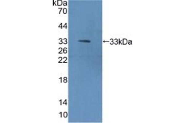 METRN Antikörper  (AA 22-291)