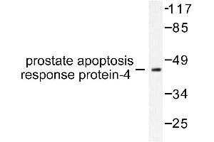 Image no. 1 for anti-PRKC, Apoptosis, WT1, Regulator (PAWR) antibody (ABIN271791) (PAWR antibody)