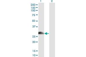 Western Blot analysis of PAGE1 expression in transfected 293T cell line by PAGE1 monoclonal antibody (M01), clone 6G6. (PAGE1 antibody  (AA 1-146))