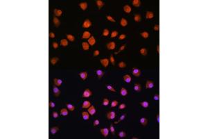 Immunofluorescence analysis of L929 cells using NPLOC4 Rabbit pAb (ABIN1681086, ABIN5664262, ABIN5664264 and ABIN6220175) at dilution of 1:100. (NPLOC4 antibody  (AA 1-270))