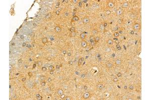 ABIN6258464 and ABIN6274298 at 1/100 staining Rat brain tissue by IHC-P. (CKS1 antibody  (N-Term))