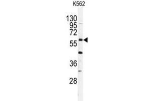 Western blot analysis of USP2 polyclonal antibody  in K-562 cell line lysates (35 ug/lane). (USP2 antibody  (C-Term))