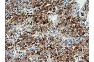 Image no. 4 for anti-Aminoacylase 1 (ACY1) antibody (ABIN1496456) (Aminoacylase 1 antibody)