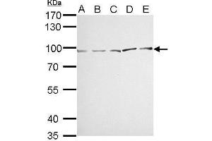 WB Image MVP/LRP antibody detects MVP protein by Western blot analysis. (MVP antibody)