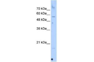Western Blot showing SEPN1 antibody used at a concentration of 1-2 ug/ml to detect its target protein.