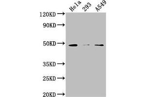Western Blot Positive WB detected in: Hela whole cell lysate, 293 whole cell lysate, A549 whole cell lysate All lanes: NXN antibody at 1:2000 Secondary Goat polyclonal to rabbit IgG at 1/50000 dilution Predicted band size: 49, 21, 37 kDa Observed band size: 49 kDa (NXN antibody  (AA 155-435))