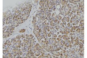 Immunohistochemistry (IHC) image for anti-Protein tyrosine Phosphatase, Receptor Type, C (PTPRC) (C-Term) antibody (ABIN6266361)