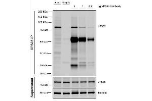 Immunoprecipitation (IP) image for anti-Vacuolar Protein Sorting 35 (VPS35) antibody (APC) (ABIN6933014)