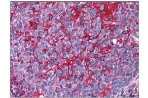 Human Tonsil: Formalin-Fixed, Paraffin-Embedded (FFPE) (ARL6IP5 antibody  (C-Term))