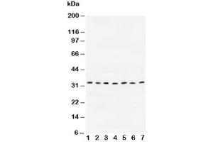 Western blot testing of Cyclin D1 antibody and Lane 1:  rat testis