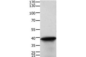 Western Blot analysis of Human cervical cancer tissue using TPM2 Polyclonal Antibody at dilution of 1:600 (TPM2 antibody)