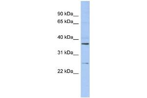 WB Suggested Anti-ZFAND6 Antibody Titration: 0. (ZFAND6 antibody  (Middle Region))