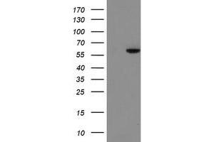HEK293T cells were transfected with the pCMV6-ENTRY control (Left lane) or pCMV6-ENTRY FTCD (Right lane) cDNA for 48 hrs and lysed. (FTCD antibody)