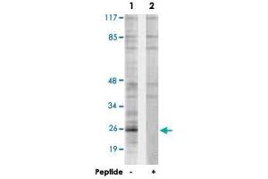 Western blot analysis of extracts from Jurkat cells, using PPP1R2 polyclonal antibody . (PPP1R2 antibody  (Ser120, Ser121))