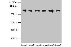 Western blot All lanes: FBXO24 antibody at 1 μg/mL Lane 1: Mouse gonadal tissue Lane 2: Mouse kidney tissue Lane 3: A549 whole cell lysate Lane 4: 293T whole cell lysate Lane 5: Jurkat whole cell lysate Lane 6: MCF-7 whole cell lysate Secondary Goat polyclonal to rabbit IgG at 1/10000 dilution Predicted band size: 65, 37, 70, 64 kDa Observed band size: 65 kDa (FBXO24 antibody  (AA 1-200))