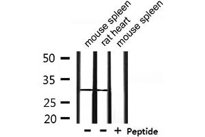 Western blot analysis of extracts from mouse spleen and rat heart, using OTUB1 Antibody. (OTUB1 antibody  (Internal Region))