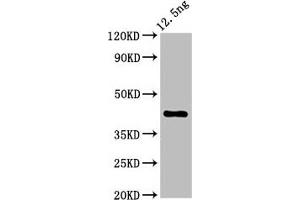 Western Blot Positive WB detected in Recombinant protein All lanes: ZAR1 antibody at 5. (Zygote Arrest 1 antibody  (AA 167-278))