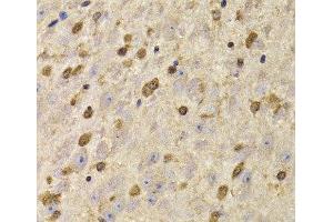 Immunohistochemistry of paraffin-embedded Mouse brain using QKI Polyclonal Antibody at dilution of 1:100 (40x lens). (QKI antibody)