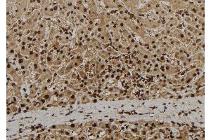 ABIN6279080 at 1/100 staining Human liver tissue by IHC-P. (ADAM33 antibody  (Internal Region))