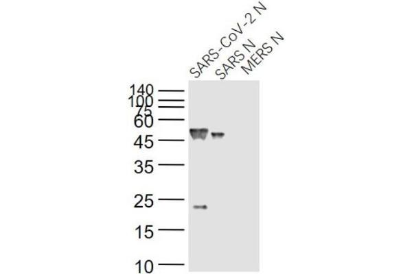 SARS-Coronavirus Nucleocapsid Protein (SARS-CoV N) antibody