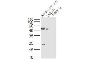 Lane 1: SARS-CoV-2 N Protein; Lane 2: Recombinant SARS N (1-422) protein; Lane 3: MERS N protein probed with SARS Nucleocapsid Protein (14B3D) Monoclonal Antibody, Unconjugated (bsm-49134M) at 1:1000 dilution and 4˚C overnight incubation. (SARS-Coronavirus Nucleocapsid Protein (SARS-CoV N) antibody)