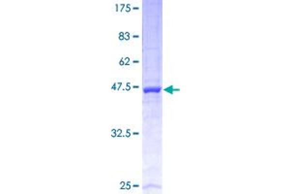 UBE2E3 Protein (AA 1-207) (GST tag)
