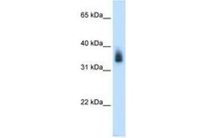 Image no. 2 for anti-Melanoma Antigen Family A, 8 (MAGEA8) (AA 51-100) antibody (ABIN6736631) (MAGEA8 antibody  (AA 51-100))