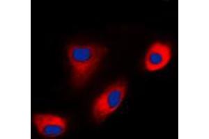 Immunofluorescent analysis of DAB1 staining in MCF7 cells. (DAB1 antibody  (Center))