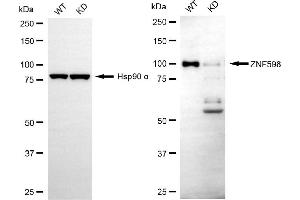 Western blotting analysis using ZNF598 antibody (ABIN7800898). (ZNF598 antibody)