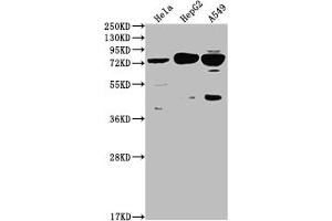 Western Blot Positive WB detected in: Hela whole cell lysate, HepG2 whole cell lysate, A549 whole cell lysate All lanes: HTR2C antibody at 1:2000 Secondary Goat polyclonal to rabbit IgG at 1/50000 dilution Predicted band size: 52, 29 kDa Observed band size: 75 kDa