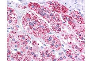 ABCB1 antibody was used for immunohistochemistry at a concentration of 4-8 ug/ml. (ABCB1 antibody)