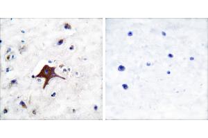 Peptide - +Immunohistochemical analysis of paraffin-embedded human brain tissue using GLUT3 antibody (#C0214). (SLC2A3 antibody)